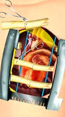  Open Heart Surgery Simulator   -   